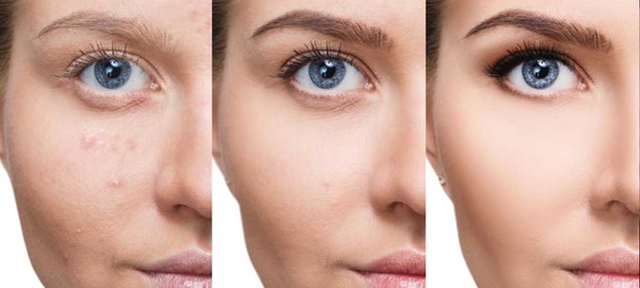 BB Glow begehrtes Verfahren für ein strahlendes Hautbild BB Glow begehrtes Verfahren für ein strahlendes Hautbild