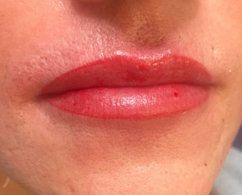 Ergebnis PMU Lippen Ergebnis PMU Lippen