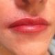 Ergebnis PMU Lippen Ergebnis PMU Lippen