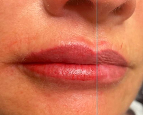 Ergebnis PMU Lippen - nachher / vorher Ergebnis PMU Lippen - nachher / vorher