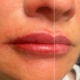 Ergebnis PMU Lippen - nachher / vorher Ergebnis PMU Lippen - nachher / vorher